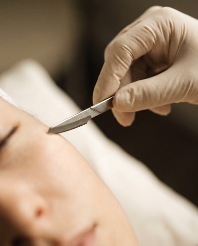 Dermaplaning